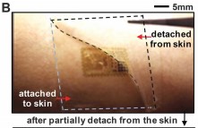 small electronic patch being taken off skin