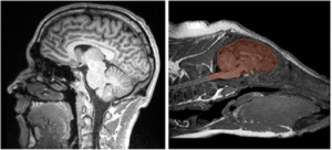 Scan showing development of human brain vs. piglet brain